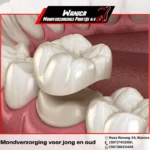 Wanica Mondverzorgings Praktijk NV V1 02 Ql8u - Image 1767 (March 18, 2026)