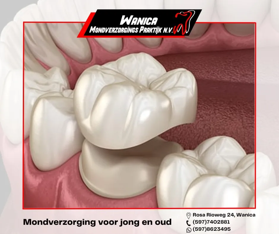 Wanica Mondverzorgings Praktijk NV V1 02 Ql8u - Image 1767 (March 18, 2026)